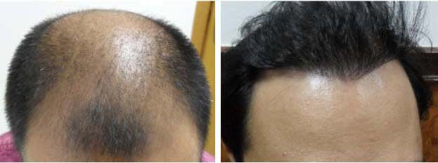 Maxim Hair Clinic